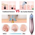 Blackhead Remover Facial Cleaner Deep Pore Acne Pimple Removal Vacuum Suction