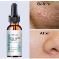 TRSTAY High Moisturizing Face Cream and Pore Shrinking Serum
