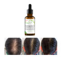 Hair Essential Oil Anti Hair Loss Oil 30g