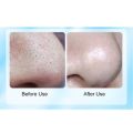 Vacuum Blackhead Remover Facial Skin Pore Acne Pimple 5 Sucker Cleaner Machine