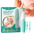 Skin Tag Remover Kit - THAT WORKS!