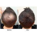 Sevich refill hair building fibers 27g - dark brown (free shipping)