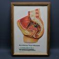 Framed Original Vintage Augmentin Embossed Medical Promotional Doctors Aid!!!