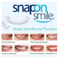 Snap on Smile Teeth veneers