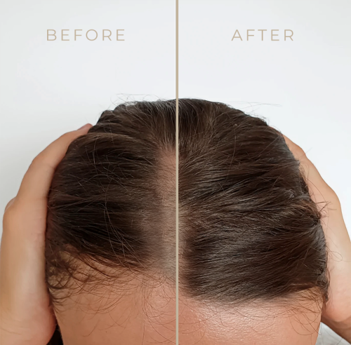 Rosemary Water For Hair Growth 50ml -CROWN SHOP 230606131058 rosemary water hair ba 1675199385070