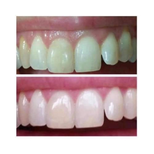 Whitening - AP-24 Whitening Toothpaste 4oz was listed for 