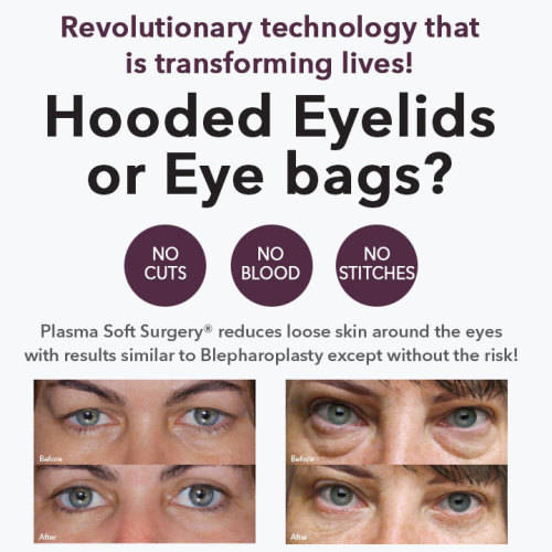 Other Home Skincare Devices Instant plasma eyelid lift,scars,wart