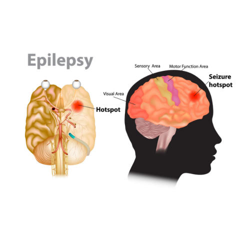 Herbal Remedies & Resins - Feelgood Health Epi-Still Natural Epilepsy ...